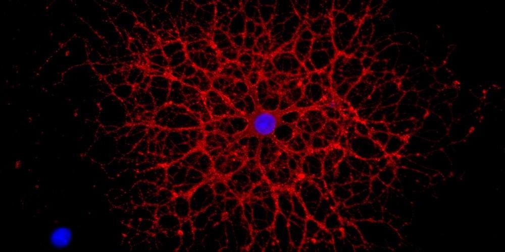 分化的少突胶质细胞，形成中枢神经系统髓鞘的细胞